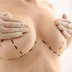 Checking the shape of the breast. The nipple position is set at
